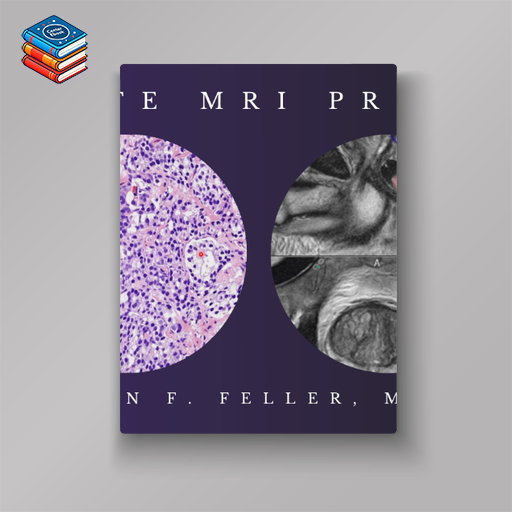 2021 Prostate MRI (Program 1) – John F. Feller