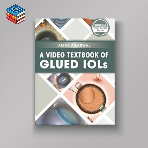 A Video Textbook of Glued IOLs