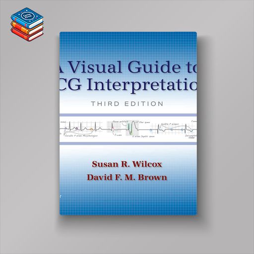 A Visual Guide to ECG Interpretation