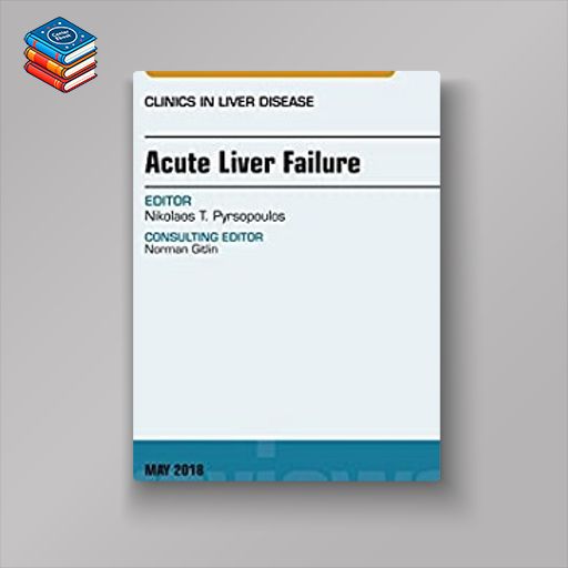 Acute Liver Failure