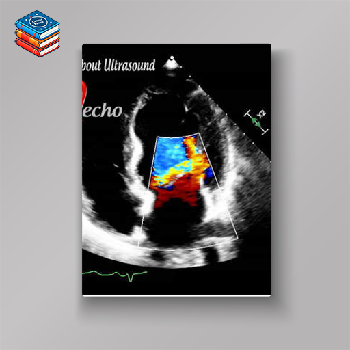 Adult Echocardiography – Test & Learn Registry Review Quiz – AllAboutUltrasound (Complete HTML)