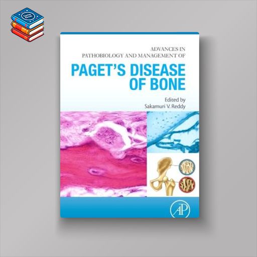 Advances in Pathobiology and Management of Paget’s Disease of Bone