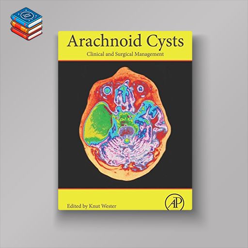 Arachnoid Cysts: Clinical and Surgical Management (EPUB)