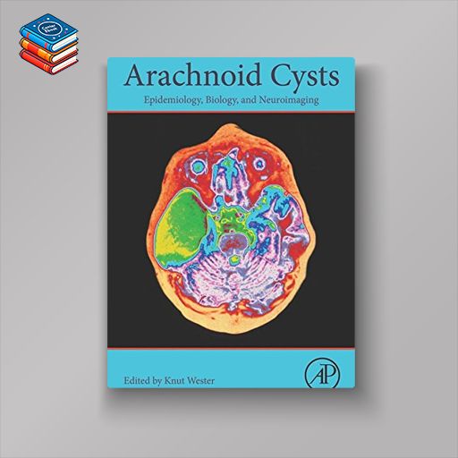 Arachnoid Cysts: Epidemiology