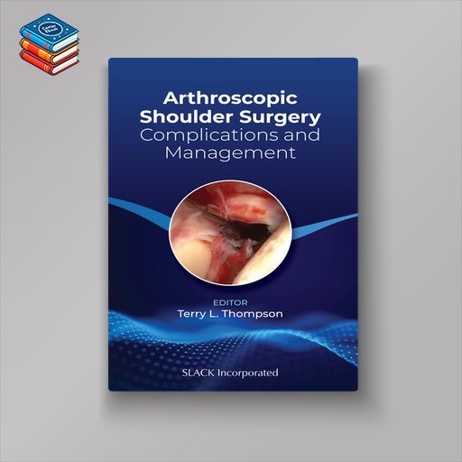 Arthroscopic Shoulder Surgery: Complications and Management (EPUB)