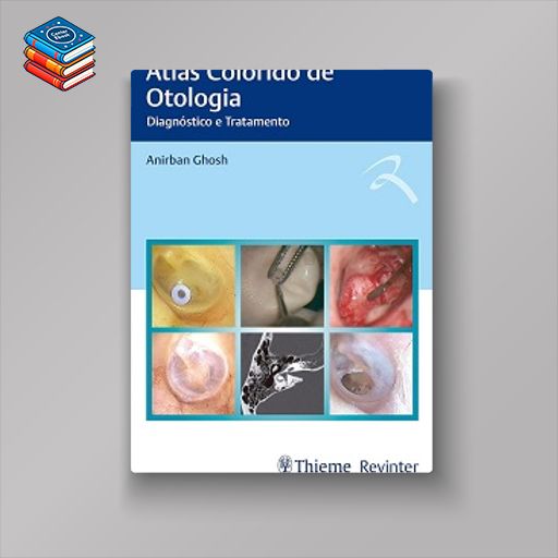 Atlas Colorido de Otologia: Diagnóstico e Tratamento (Portuguese Edition) (EPUB)