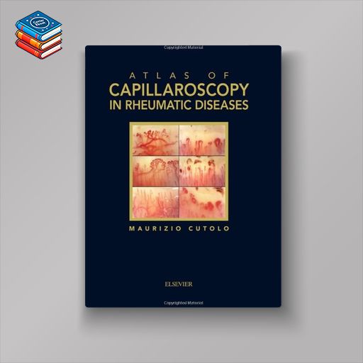 Atlas of capillaroscopy in rheumatic diseases (Original PDF from Publisher)