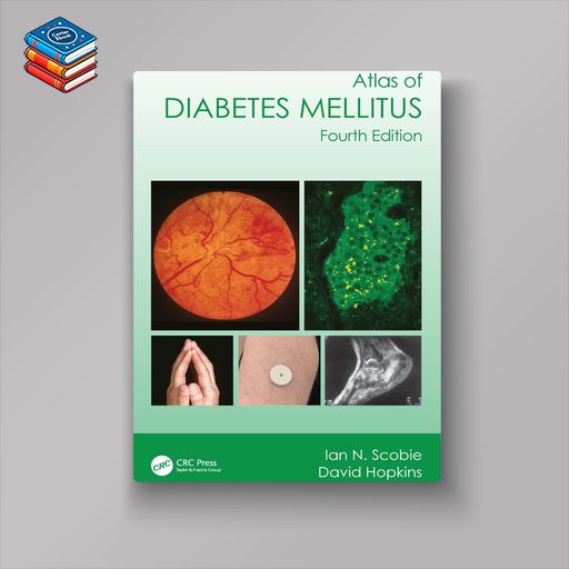 Atlas of Diabetes Mellitus