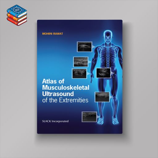 Atlas of Musculoskeletal Ultrasound of the Extremities (EPUB)