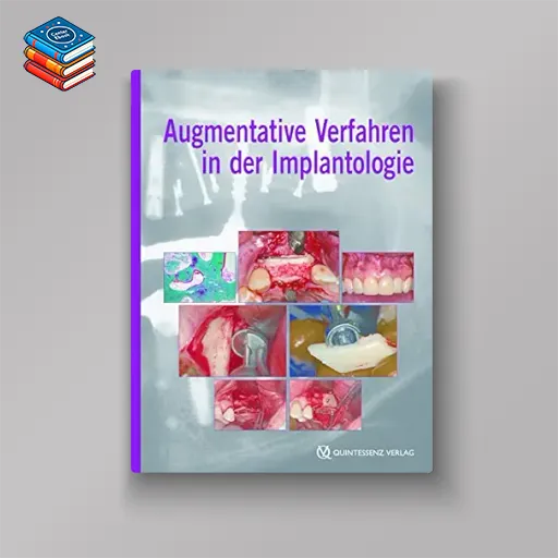 Augmentative Verfahren in der Implantologie (German Edition) (EPUB)