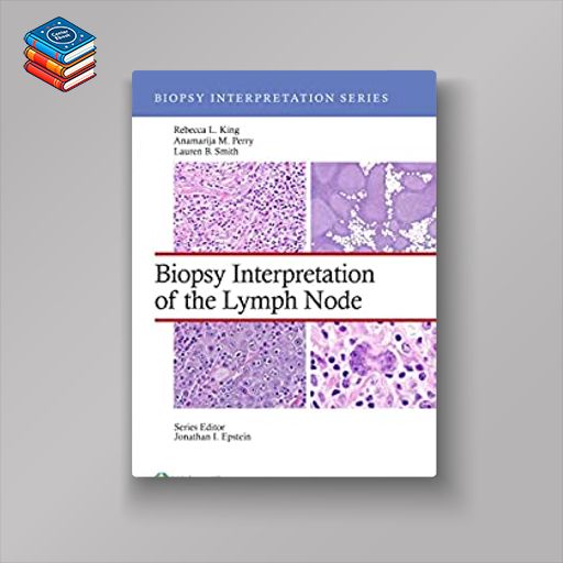 Biopsy Interpretation of the Lymph Nodes (Biopsy Interpretation Series) (EPUB)