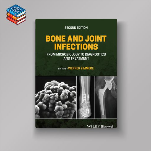 Bone and Joint Infections: From Microbiology to Diagnostics and Treatment