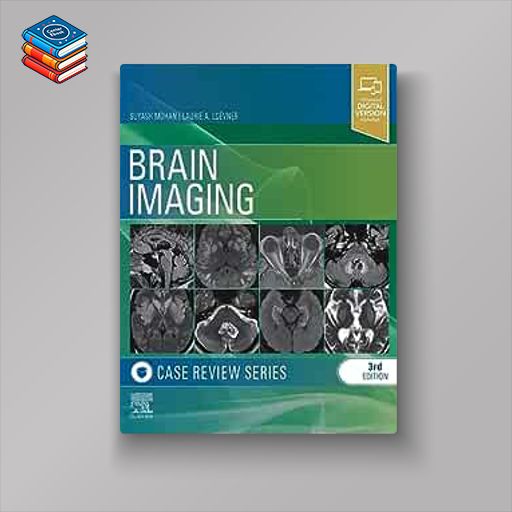 Brain Imaging: Case Review Series