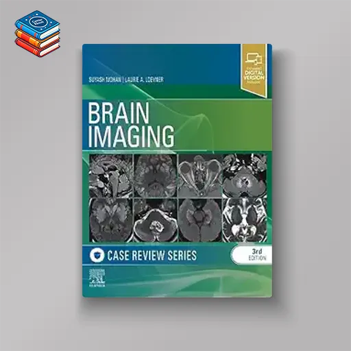 Brain Imaging: Case Review Series