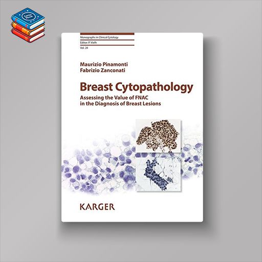 Breast Cytopathology: Assessing the Value of FNAC in the Diagnosis of Breast Lesions (Monographs in Clinical Cytology