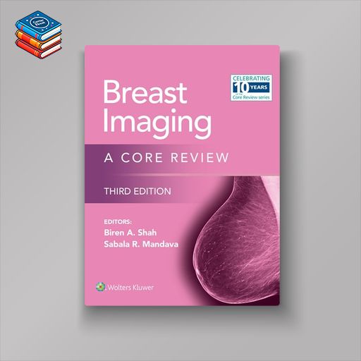 Breast Imaging (EPUB)