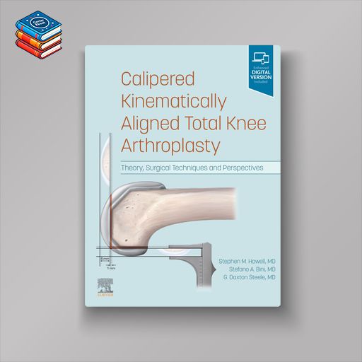 Calipered Kinematically aligned Total Knee Arthroplasty: Theory