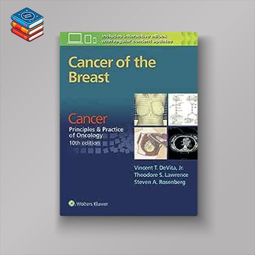 Cancer of the Breast