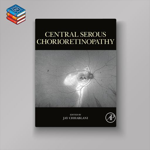 Central Serous Chorioretinopathy (EPUB)