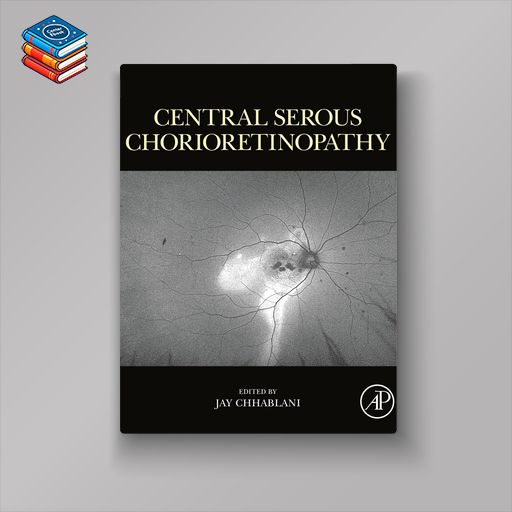 Central Serous Chorioretinopathy (Original PDF from Publisher)