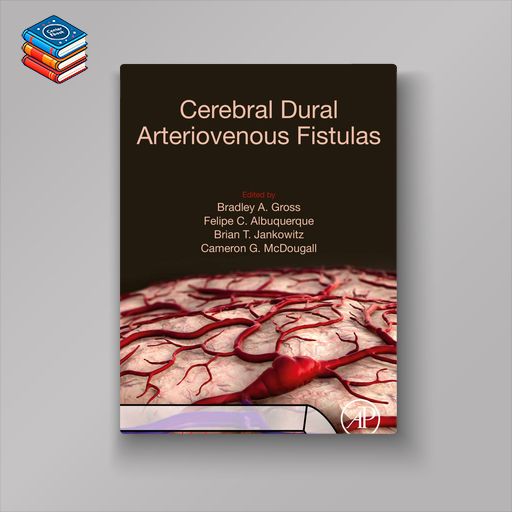 Cerebral Dural Arteriovenous Fistulas (EPUB)