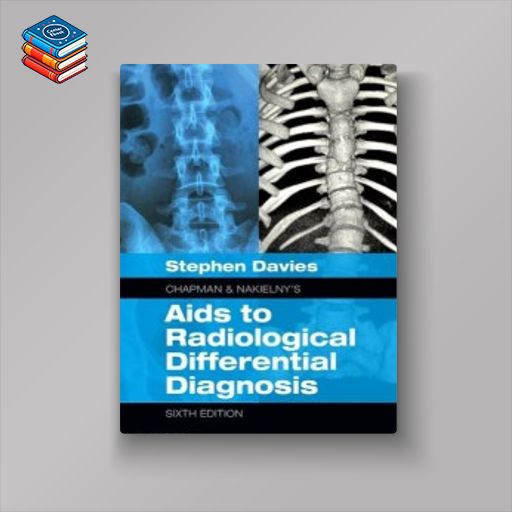 Chapman & Nakielny’s Aids to Radiological Differential Diagnosis: Expert Consult – Online and Print