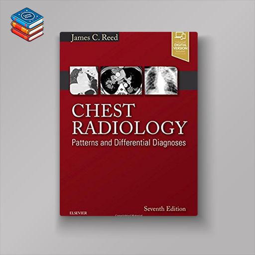 Chest Radiology: Patterns and Differential Diagnoses