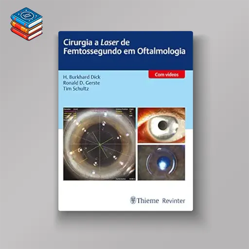 Cirurgia a Laser de Femtossegundo em Oftalmologia (Portuguese Edition) (Original PDF from Publisher)