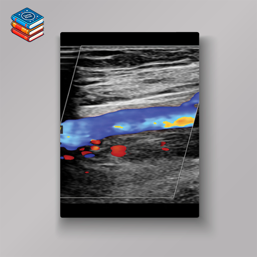 Clinical Approach to Vascular Ultrasound and RPVI Prep Course 2023 (Videos)