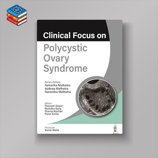 Clinical Focus on Polycystic Ovary Syndrome (ePub)