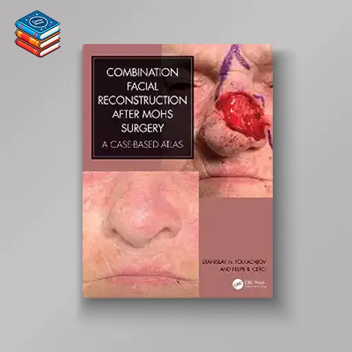 Combination Facial Reconstruction after Mohs Surgery: A Case Based Atlas (Original PDF from Publisher)