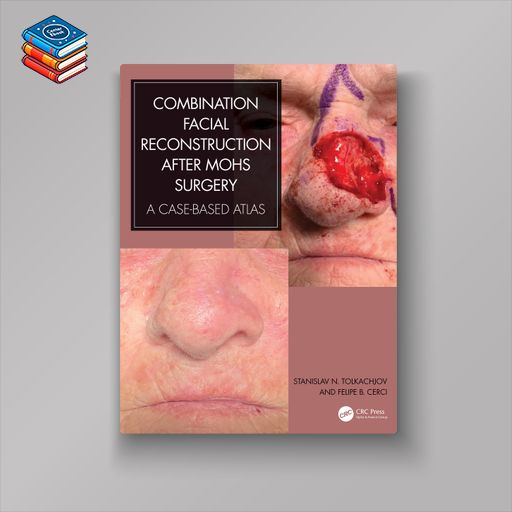 Combination Facial Reconstruction after Mohs Surgery (EPUB)