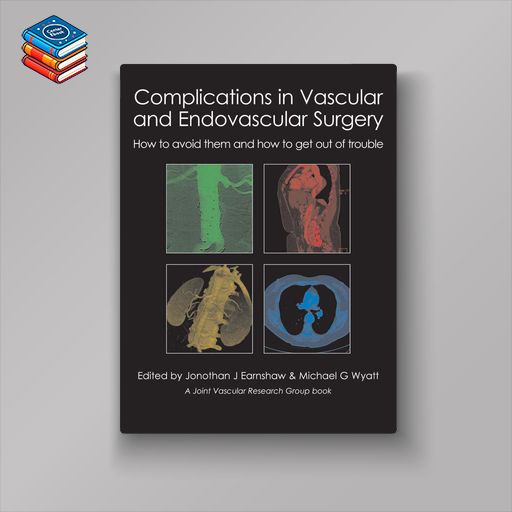 Complications in Vascular and Endovascular Surgery: How to avoid them and how to get out of trouble (EPUB)