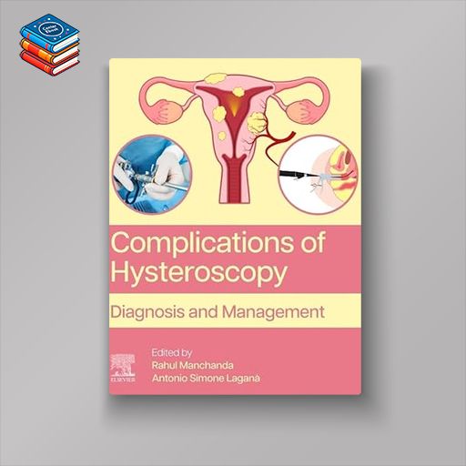 Complications of Hysteroscopy: Diagnosis and Management (Original PDF from Publisher)