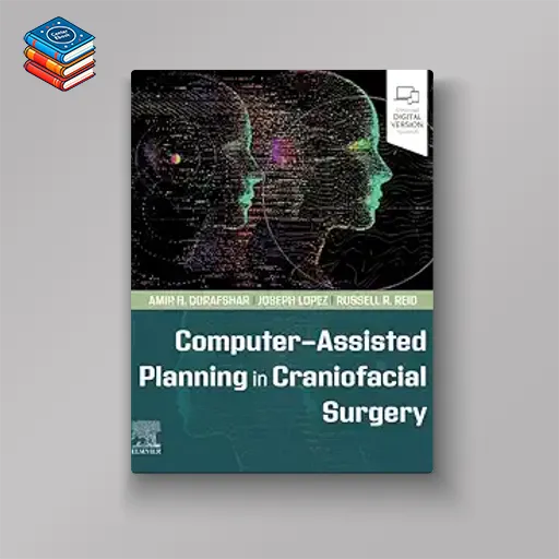 Computer-Assisted Planning in Craniofacial Surgery (True PDF from Publisher)