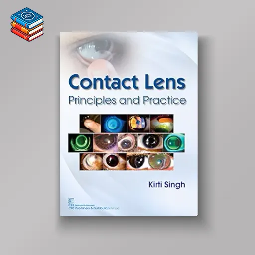 Contact Lens Printiples and Practice (Modern System of Ophthalmology (MSO) Series) (AZW3 + EPUB + Converted PDF)