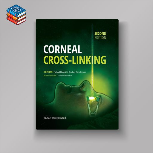 Corneal Cross-Linking