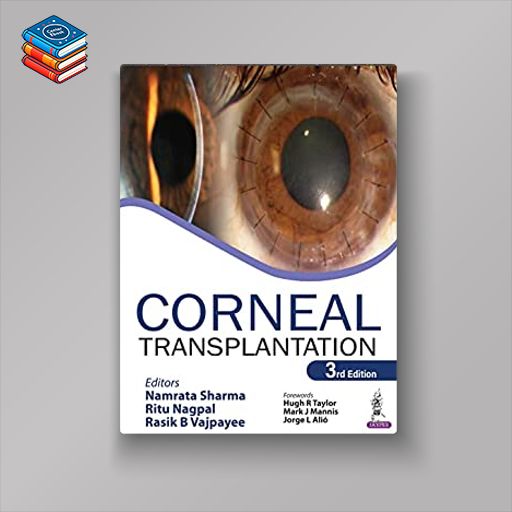 Corneal Transplantation