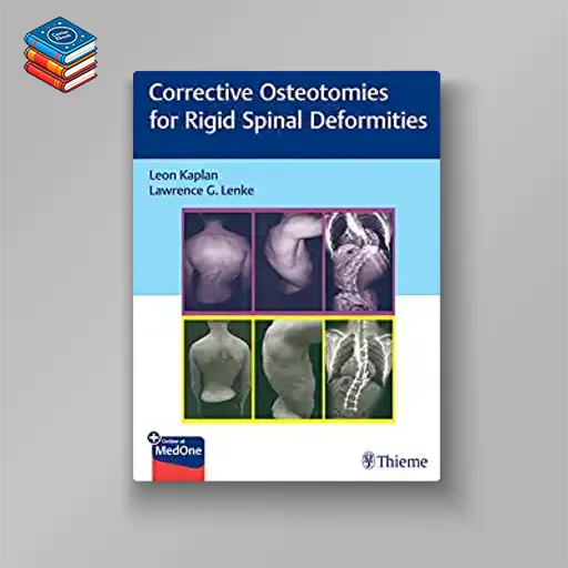 Corrective Osteotomies for Rigid Spinal Deformities (Original PDF from Publisher)