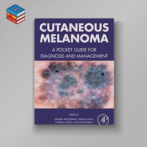 Cutaneous Melanoma: A Pocket Guide for Diagnosis and Management (EPUB)