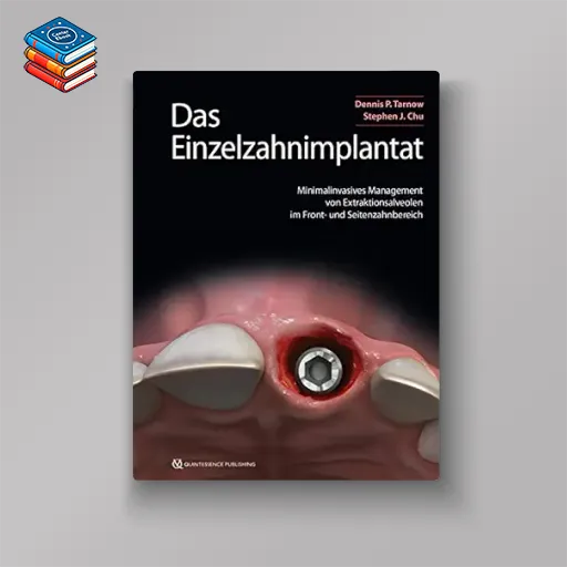 Das Einzelzahnimplantat: Minimalinvasives Management von Extraktionsalveolen im Front- und Seitenzahnbereich (German Edition) (EPUB)