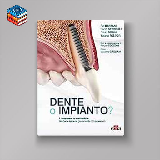 Dente o impianto? Il recupero e la sostituzione del dente naturale gravemente compromesso (EPUB)