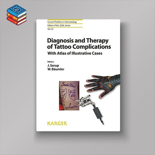 Diagnosis and Therapy of Tattoo Complications: With Atlas of Illustrative Cases (Current Problems in Dermatology