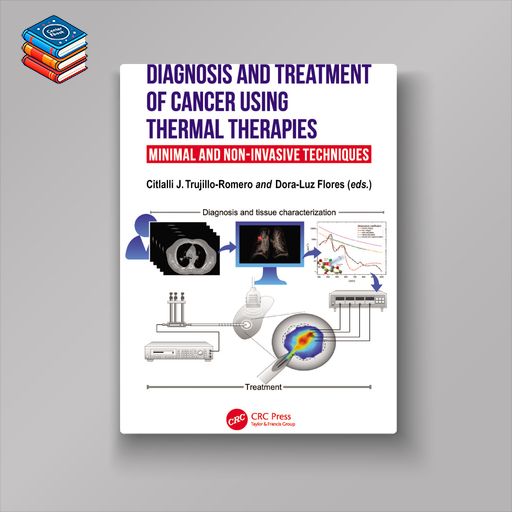 Diagnosis and Treatment of Cancer using Thermal Therapies (EPUB)