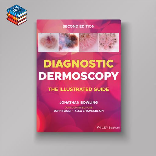 Diagnostic Dermoscopy: The Illustrated Guide