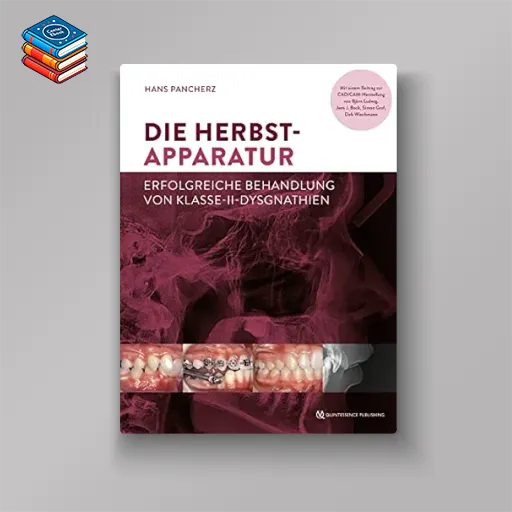 Die Herbst-Apparatur: Erfolgreiche Behandlung von Klasse-II-Dysgnathien (German Edition) (EPUB)