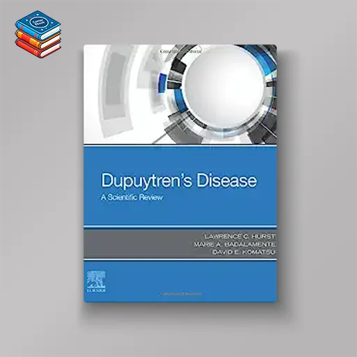 Dupuytren’s Disease: A Scientific Review (EPUB)