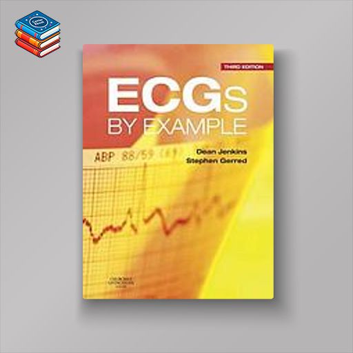 ECGs by Example