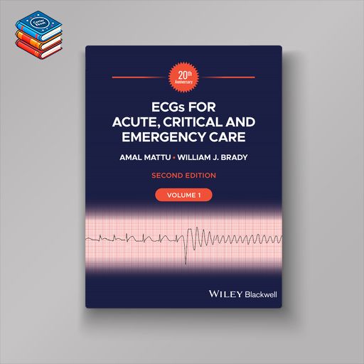 ECGs for Acute