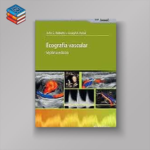 Ecografía Vascular